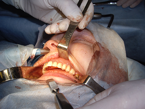 стоматолог и хирург